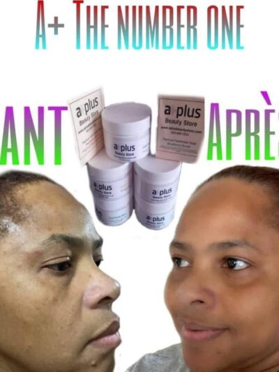 Lotions